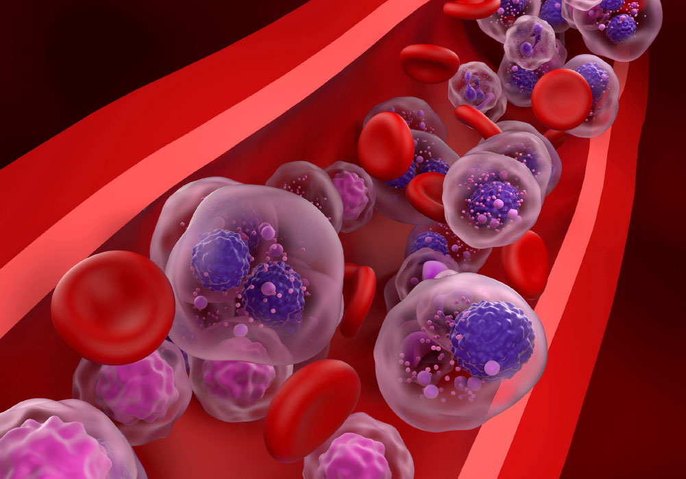 multiple myeloma genomics