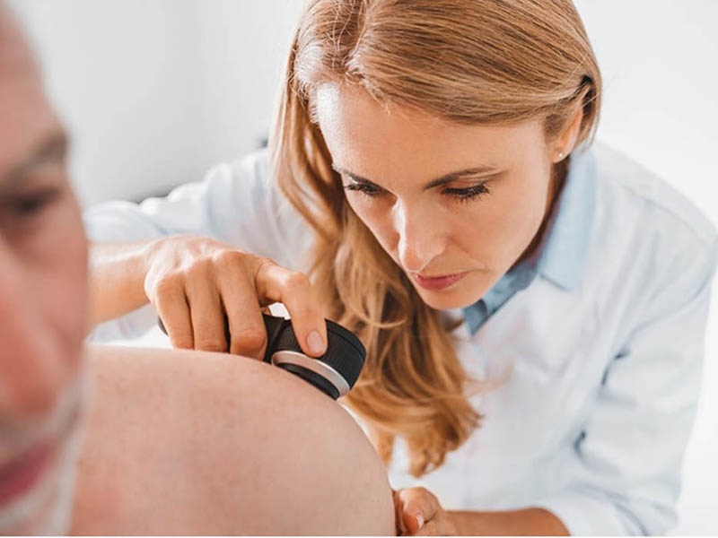woman physician using dermatoscope to examine for Merkel cell carcinoma
